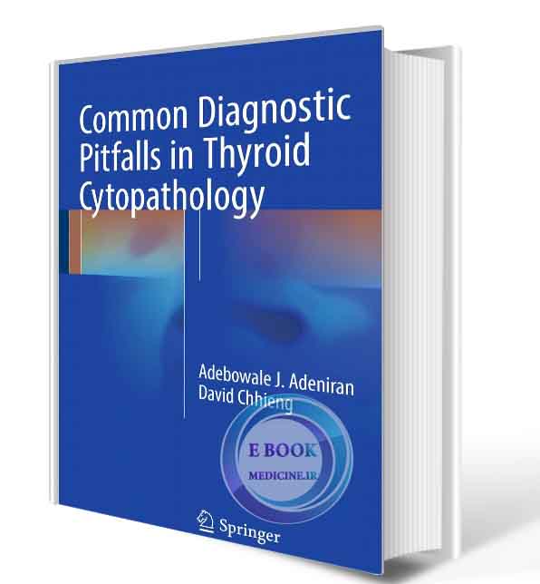 دانلود کتاب Common Diagnostic Pitfalls in Thyroid Cytopathology  2017 (ORIGINAL PDF)